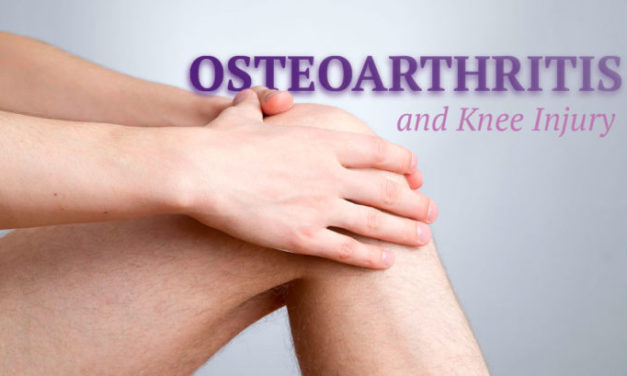 Stem Cell Therapy for Osteoarthritis