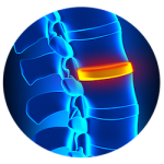Back Pain DJD & Arthritis