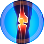 Stem Cell Therapy for Knee Pain & Injury