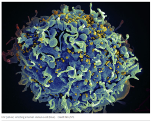 HIV infecting a human immune cell_NIH